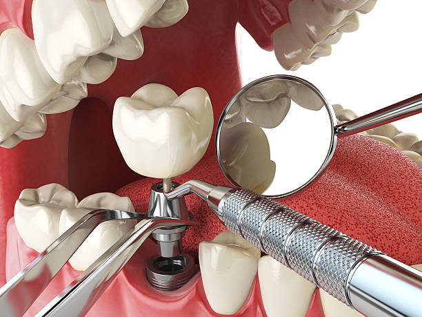 Best Emergency Wisdom Tooth Extraction in Wagoner, OK